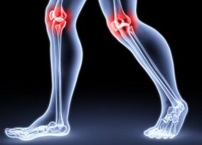 Causes of joint development of the knee