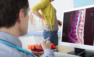 Diagnostic methods for lumbar osteochondrosis
