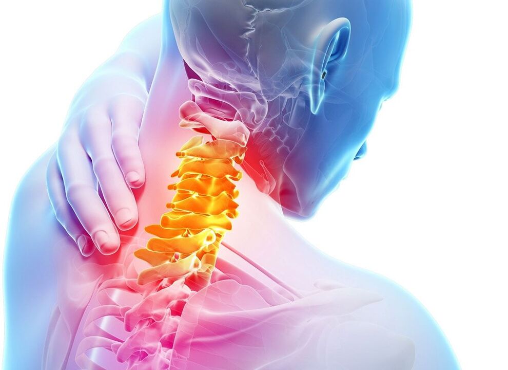 osteochondrosis of the cervical spine